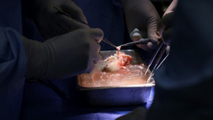 Des chirurgiens américains ont transplanté un rein de porc sur un patient vivant, une première